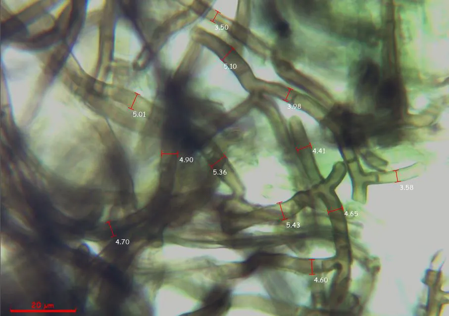 Microscopía de Polyozellus rotundisporus - 10 - Anchura hifas subiculares